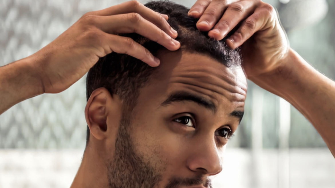 Hair Transplant (FUE & DHI)
